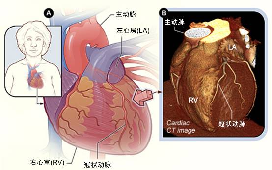 冠心病需要做哪些檢查？(圖2)